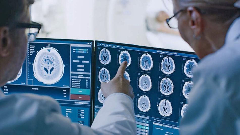 20210110_cerebro_medicina_cedoc_g