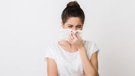 El tiempo de sangrado es de 7 a 10 minutos, es el lapso en el que se forma el coágulo.