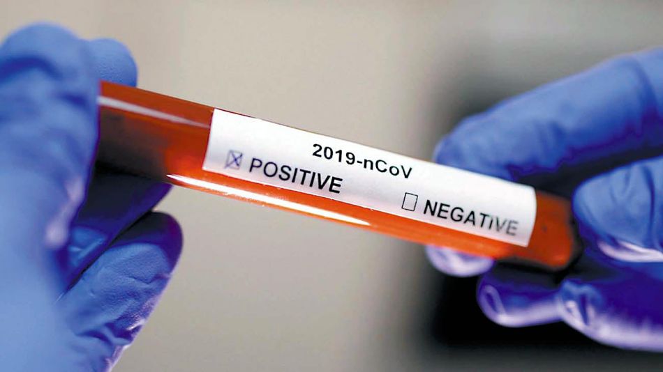 20210116_pcr_coronavirus_cedoc_g