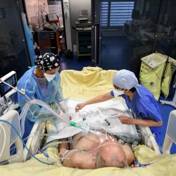 El personal médico atiende a un paciente en la unidad de cuidados intensivos para pacientes infectados con el Covid-19 (nuevo coronavirus) en el hospital AP-HP Tenon. | Foto:Alain Jocard / AFP