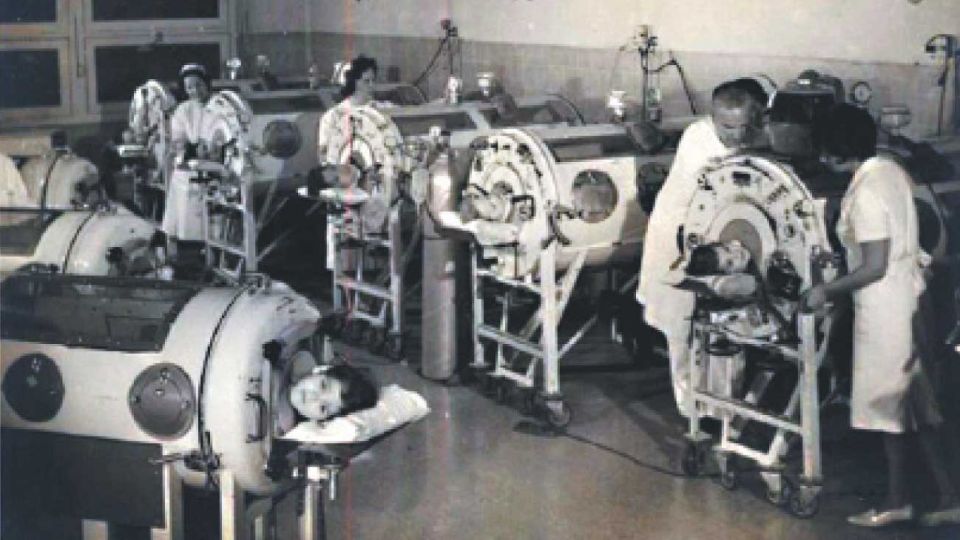 Polio, 1956. Miles enfermaron en Argentina antes de la vacuna. Pulmotores en un hospital.