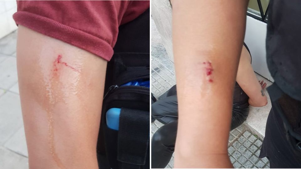 choque floresta 20210302