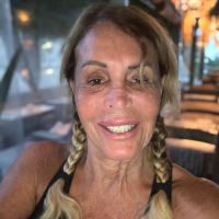 La salud de Pata Villanueva a un mes de su accidente doméstico en Punta del Este