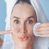 Es muy importante que te desmaquilles y limpies el rostro cada día para dejar respirar a los poros y evitar que se formen los puntos negros.