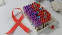 Estudio MOSAICO Vacuna VIH