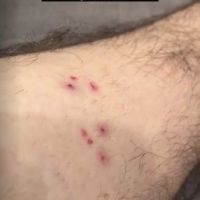 El "youtuber" Damián Kuc fue atacado por una anaconda