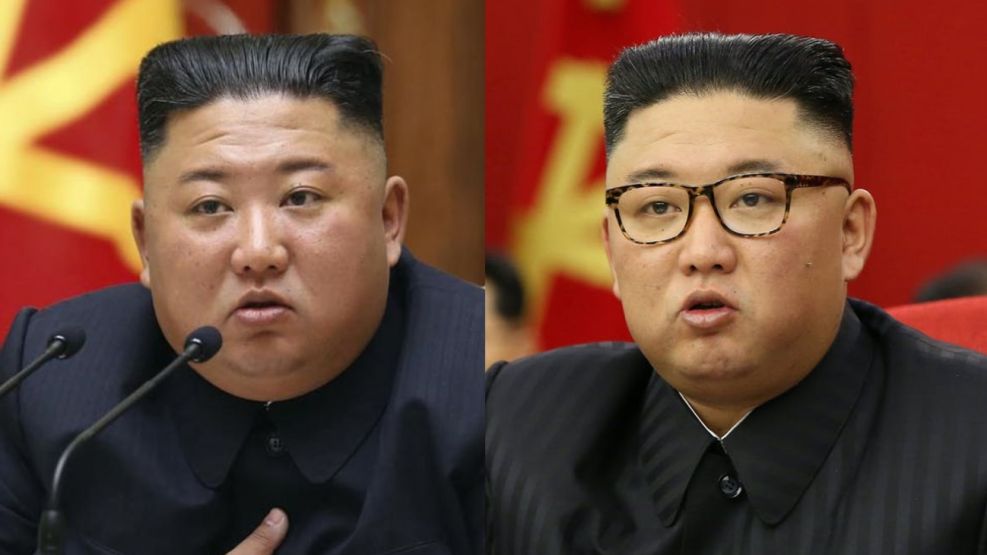 Kim Jong-un Salud