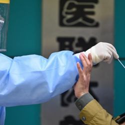 Un hombre que se somete a la prueba del nuevo coronavirus COVID-19 reacciona mientras un trabajador médico toma una muestra de hisopo en Wuhan, en la provincia central china de Hubei. | Foto:Héctor Retamal / AFP