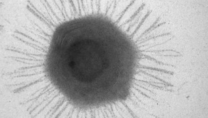 Los mimivirus se confundieron inicialmente con bacterias cuando los científicos las vieron por primera vez durante un brote de neumonía en 1992. Desde entonces, el mundo científico lleva décadas intrigado por ellos.