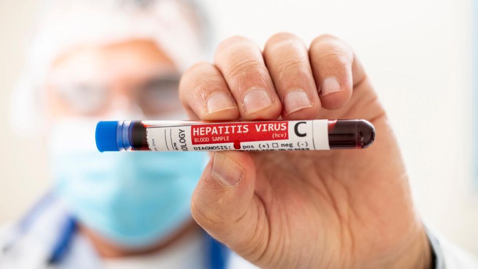Hepatitis 20210728