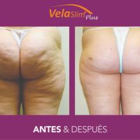 VELASLIM plus