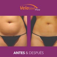 VELASLIM plus