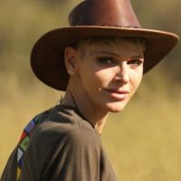 Charlène de Mónaco tuvo que realizarte una nueva operación