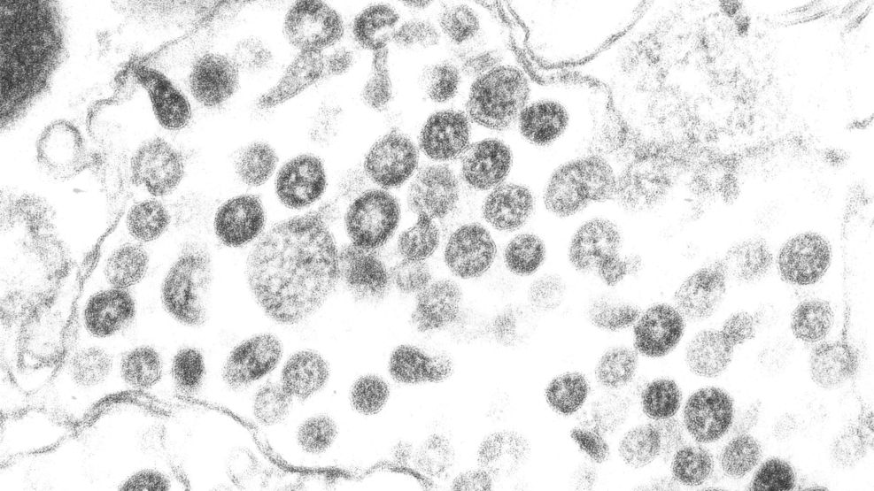 CDC Releases Microscopic Images Of Suspected SARS Virus