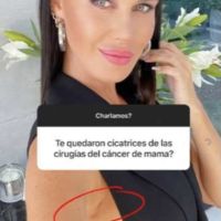 Natalie Weber mostró las cicatrices que le quedaron tras su mastectomía