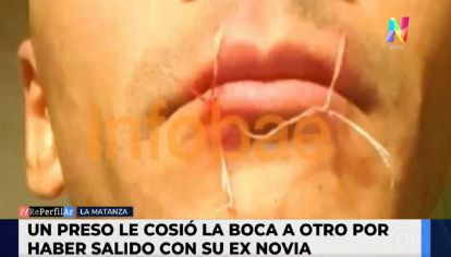 Le cosieron la boca a un preso en La Matanza
