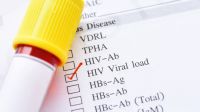 análisis positivo de VIH 20211007