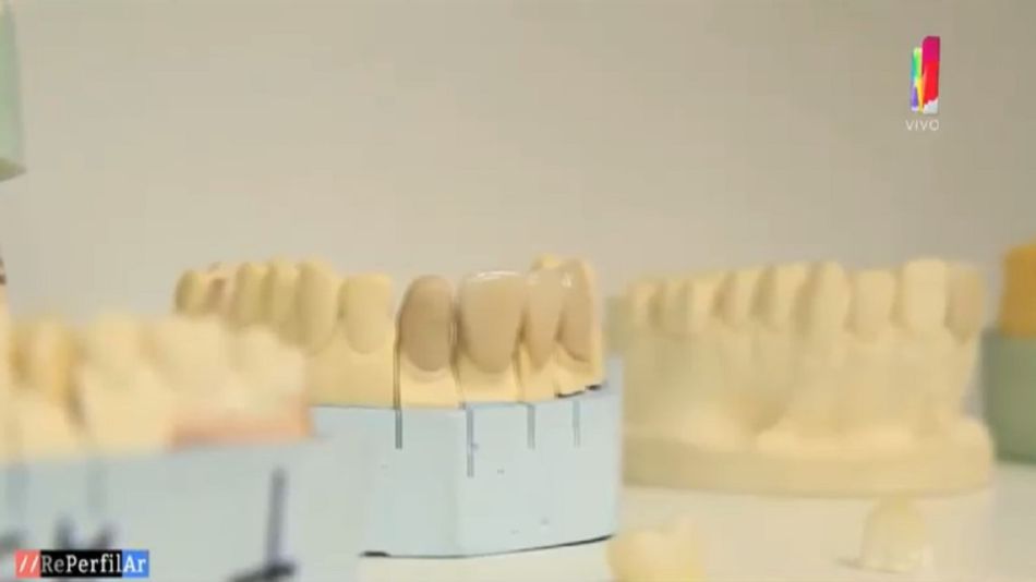 Nueva tecnología: ¿Qué es la ortodoncia en tres dimensiones?