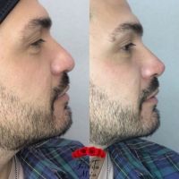 Estética Fridita Mía