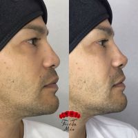 Estética Fridita Mía