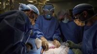 trasplante riñón cerdo paciente humano g_20211021