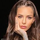 Cande Tinelli mostró su nuevo rostro tras someterse a una cirugía estética