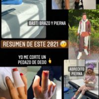 Emma, la hija menor de Evangelina Anderson sufrió un doloroso y fuerte accidente