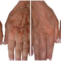 Dr. Martin Prio: Cirugías estéticas para rejuvenecer