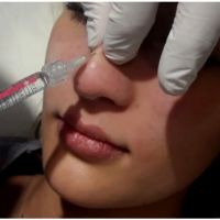 Dr. Martin Prio: Cirugías estéticas para rejuvenecer