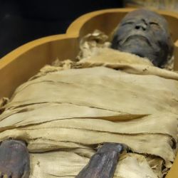 Los científicos extrajeron el ADN del "cemento" de liendres de especímenes que fueron recogidos de tres momias sanjuaninas.