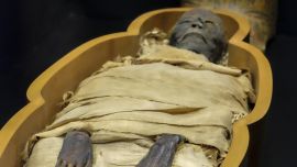 Los científicos extrajeron el ADN del "cemento" de liendres de especímenes que fueron recogidos de tres momias sanjuaninas.