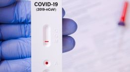 Bioquímicos aseguran que los autotest de covid-19 son inconvenientes