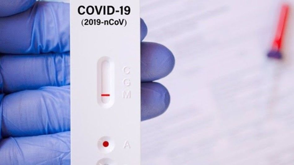 Bioquímicos aseguran que los autotest de covid-19 son inconvenientes