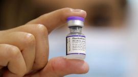 Investigan problemas auditivos en personas vacunadas con Pfizer, Astrezeneca, Moderna y Sinovac