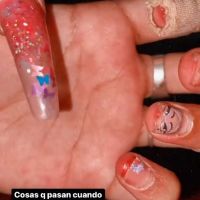 Tamara Báez la novia de L-Gante fue brutalmente agredida