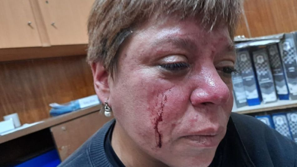 La inspectora municipal golpeada cuando fue a atender los reclamos por ruidos molestos en una fiesta en La Plata.