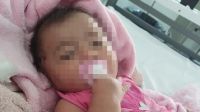 Una beba de 5 meses resultó herida con una bala de goma en la cabeza