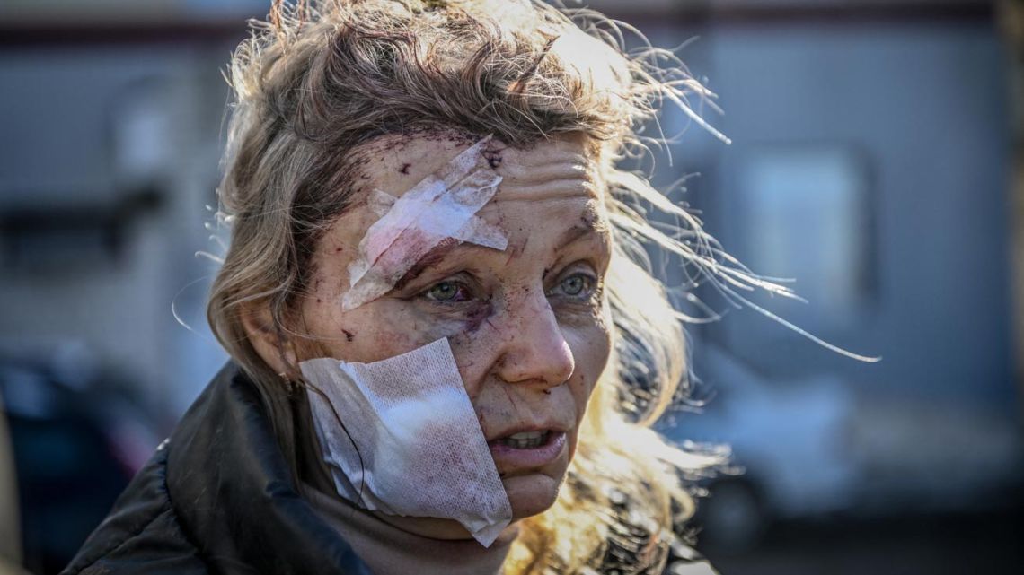 Helena, a 53-year-old teacher stands outside a hospital after the bombing of the eastern Ukraine town of Chuguiv on February 24, 2022, as Russian armed forces attempt to invade Ukraine from several directions.