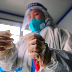 Un trabajador médico recoge una muestra para analizar el coronavirus Covid-19 en Shenyang, en la provincia nororiental china de Liaoning. | Foto:AFP