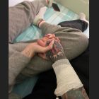 Operacion tumor pancreas Fedez