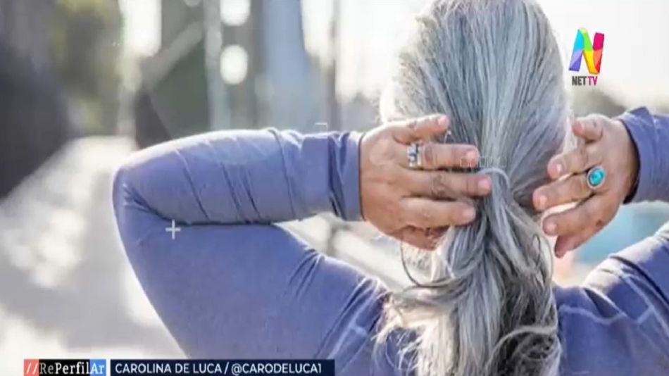 Canas: qué son y cuáles son las mejores maneras de prevenir su aparición