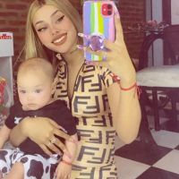 Tamara Báez sorprendió con su nuevo retoque estético