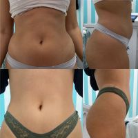 Dermatocosmiatra