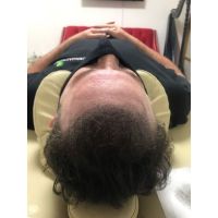 Vidalina MicroScalp