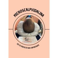 Vidalina MicroScalp