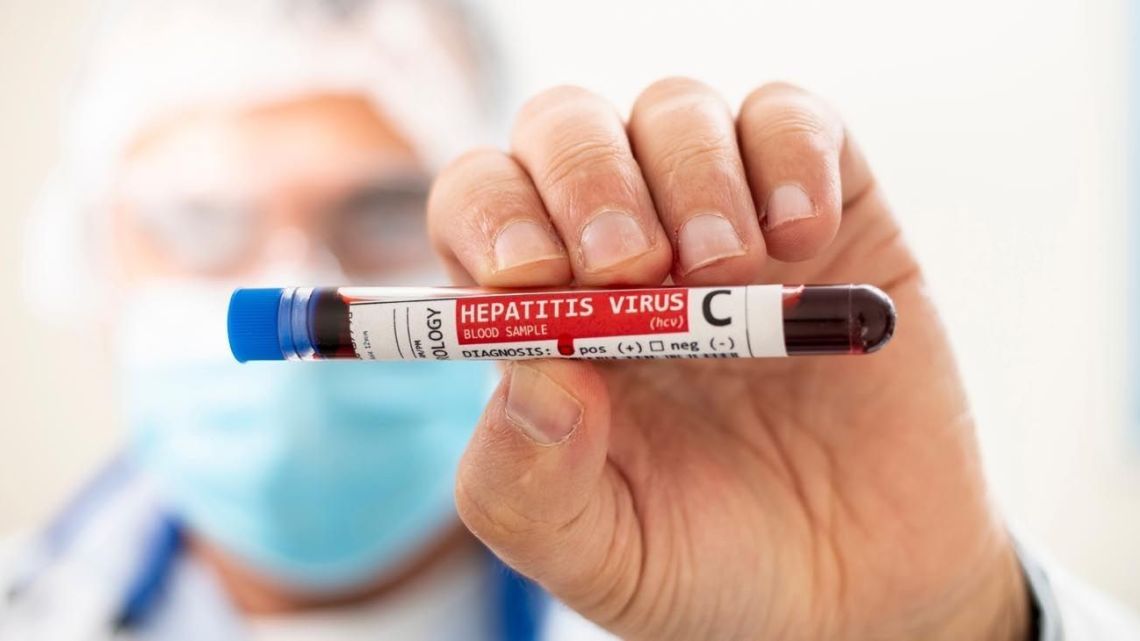 A blood sample labelled Hepatitis Virus C.