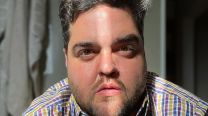Darío Barassi
