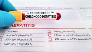 Hepatitis infantil aguda 20220505
