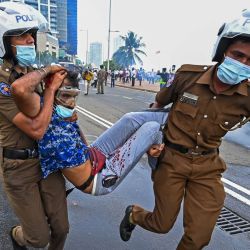 Unos policías llevan a un hombre herido durante un enfrentamiento entre partidarios del gobierno y manifestantes frente a la oficina del presidente en Colombo, Sri Lanka. | Foto:ISHARA S. KODIKARA / AFP