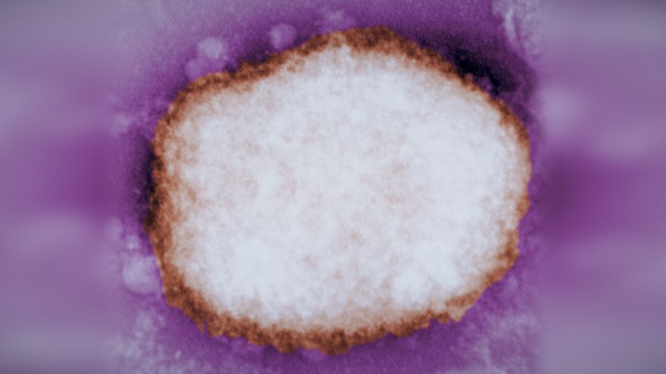 viruela mono